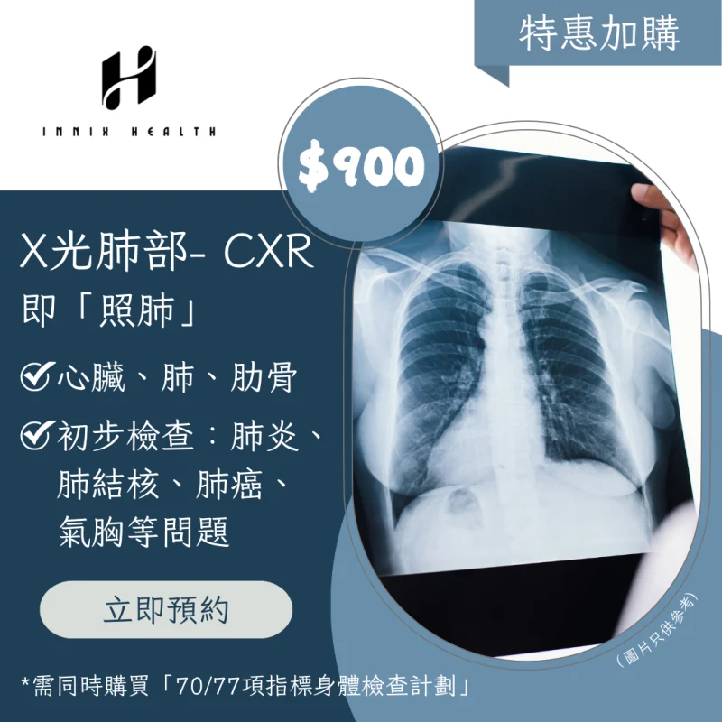 胸部X光檢查